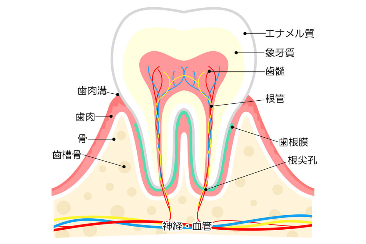 エナメル質が削られる（欠ける）ケース